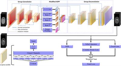 AX-Unet: A Deep Learning Framework for Image Segmentation to Assist Pancreatic Tumor Diagnosis